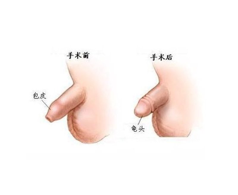 厦门出入境检验检疫局：守护厦门口岸安全的坚实屏障
