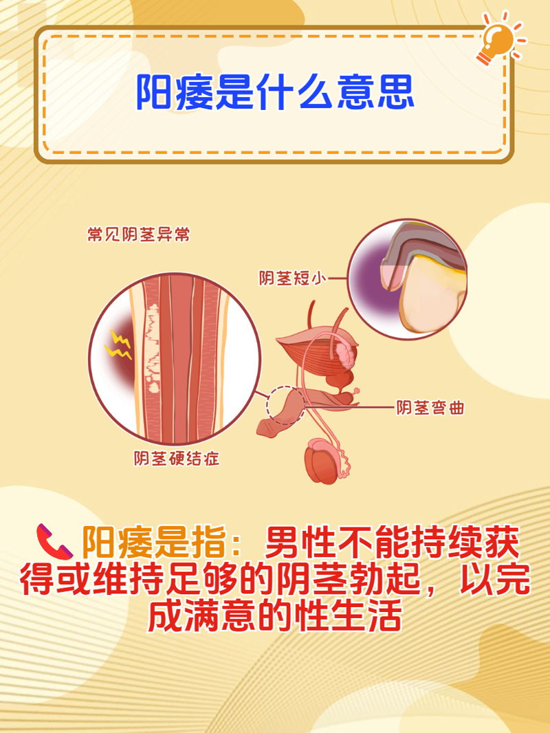 泌尿系结石：你了解多少？