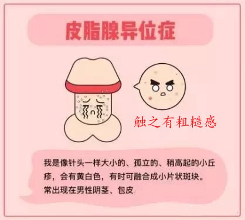 男科体检需要挂什么科室？很多人对此一筹莫展。其实，选择合适的科室对于确保健康至关重要。