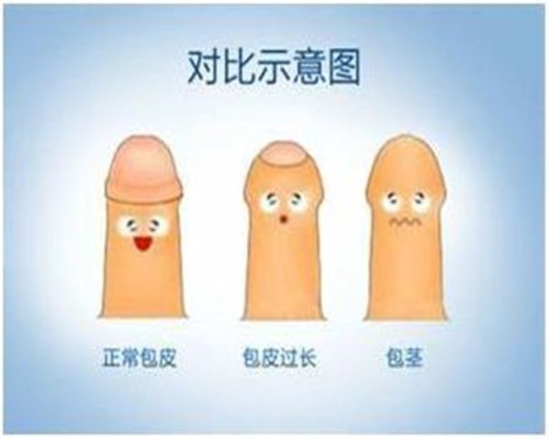 如何在家享受专业泌尿外科医生的服务