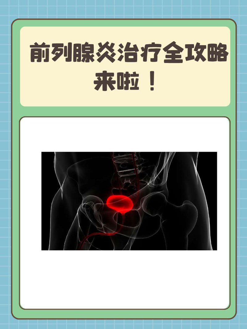 前列腺炎有哪些症状表现？男性朋友们，你们知道吗？前列腺炎是男性常见的一种疾病，它的出现常常让人措手不及。今天就来为大家详细解析前列腺炎的症状表现。